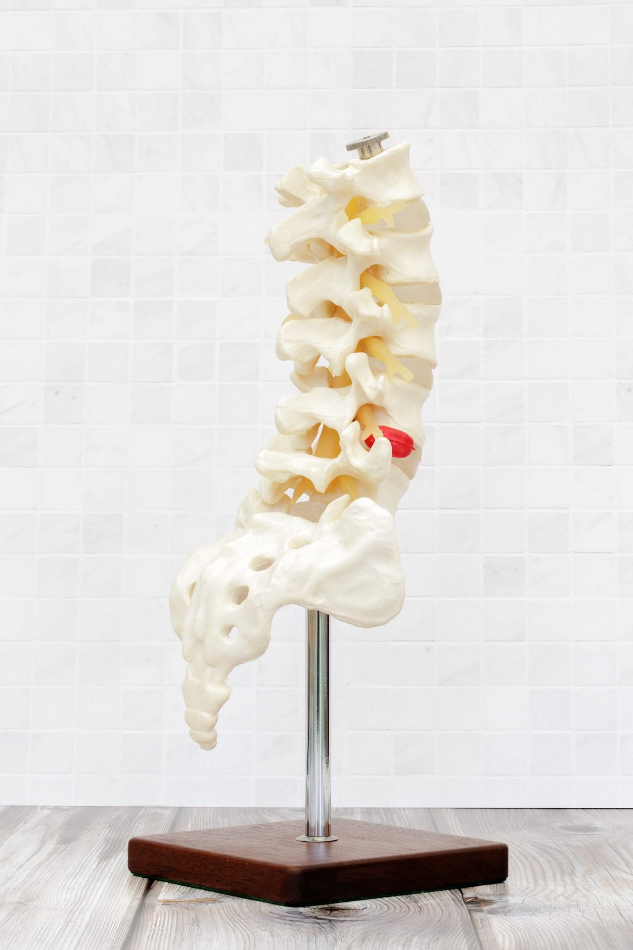 A model of a thoracic spine shot on a wooden table and white tiled background, showing back and side view of spine and a herniated disc